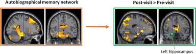 Cognitive interventions for memory and psychological well-being in aging and dementias